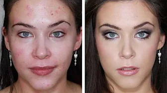 ⁣ACNE FOUNDAION ROUTINE FOR FLAWLESS SKIN - FULL COVERAGE TUTORIAL for BLEMISHES, ACNE, SCARING