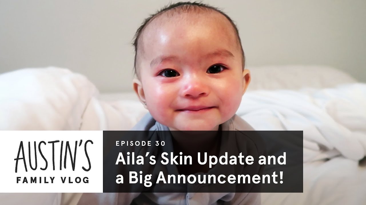 ⁣Aila s Skin Update and a Big Announcement! | Austin Vlog | HiHo Kids